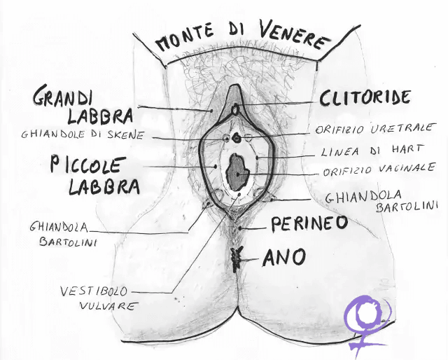 Tumore della vulva, Melanoma vulvare, Sintomi e Testimonianze